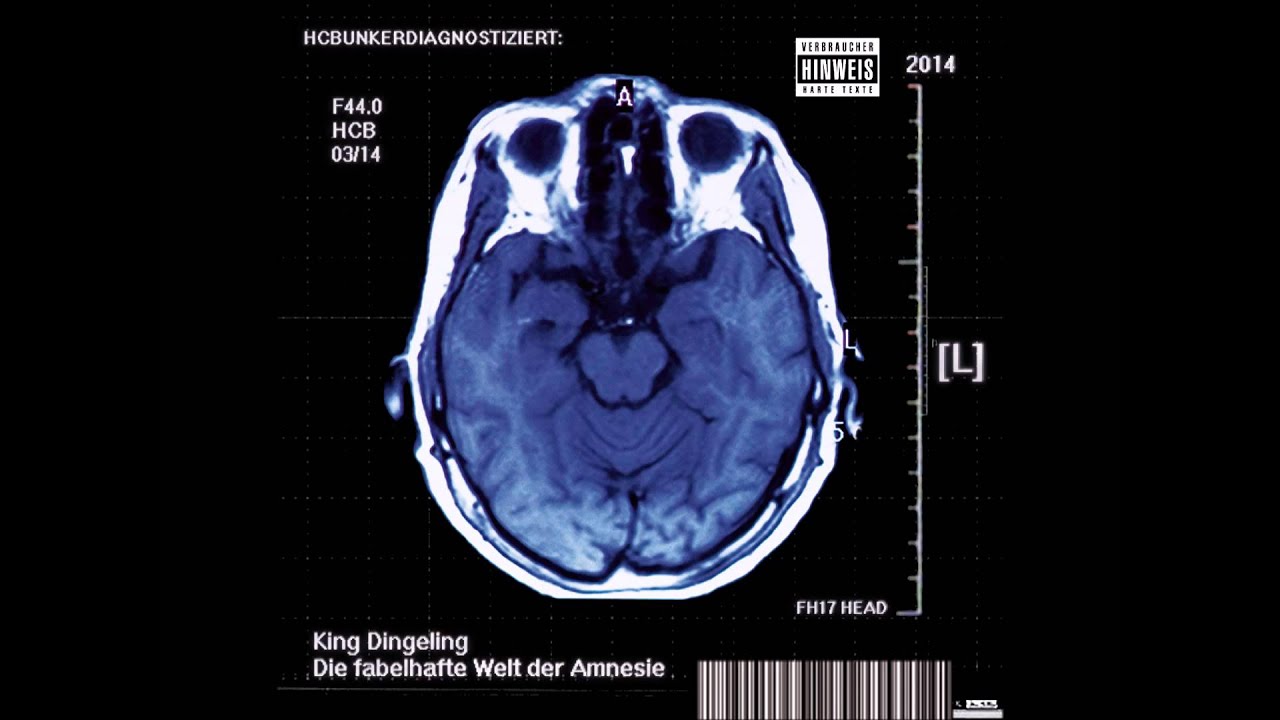 King Dingeling - R&B (Rape & Beat feat. Diggla & Koleric) (2014) (Track 8)