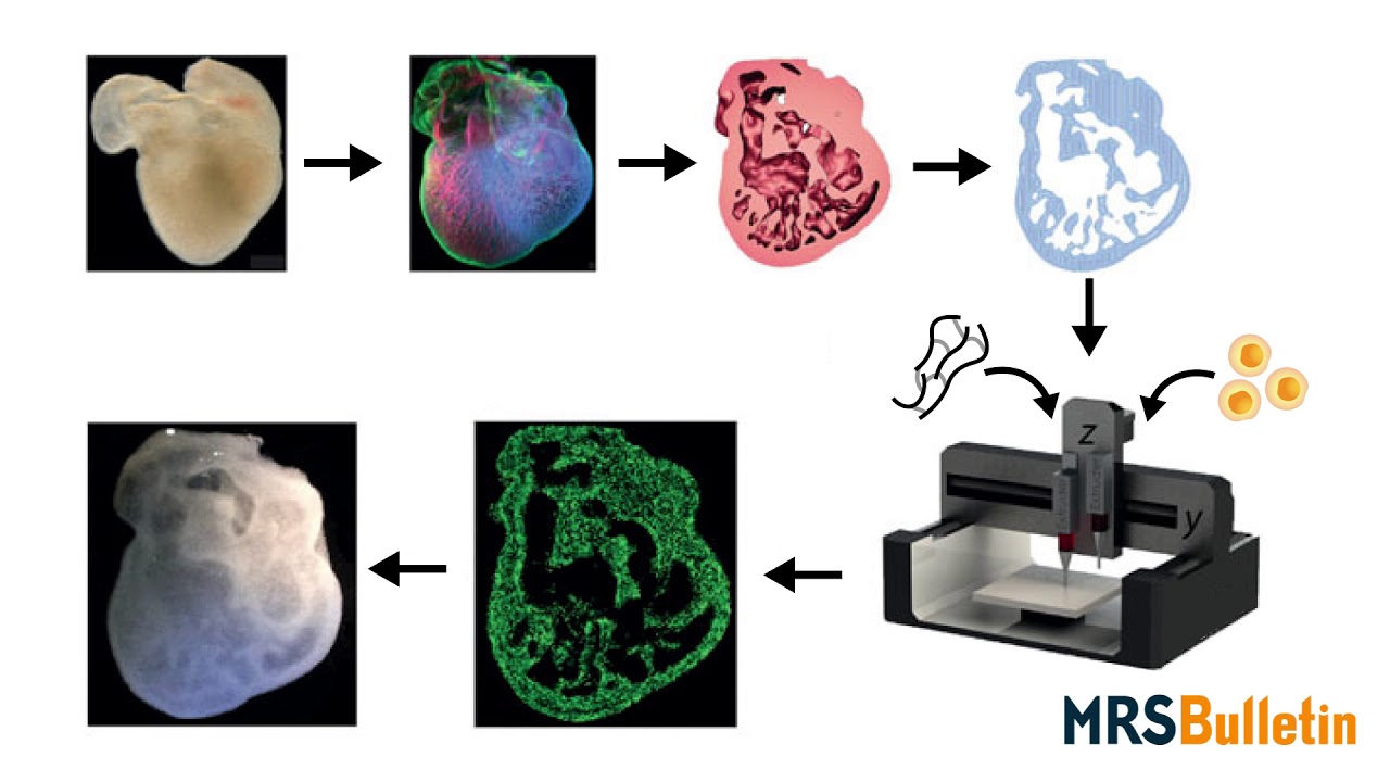 3D bioprinting of organs