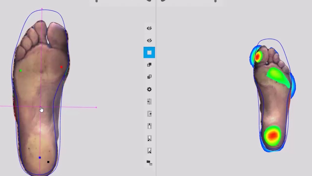Voxelcare Insole CAD CAM