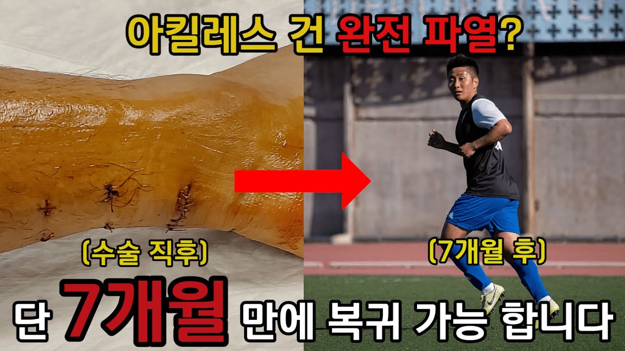 아킬레스건 완전파열 수술 후 다음날 퇴원!? 스페인 축구 선수의 203일간의 여정... (VLOG)
