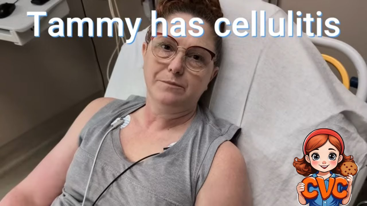 Tammy in Hospital - Chris Explains Why - What is Cellulitus & Lumphedema