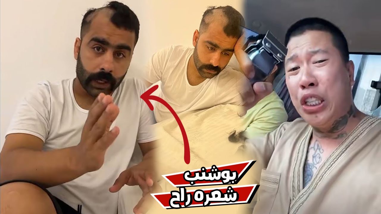 مقلب ازاله الشعر في بوشنب
