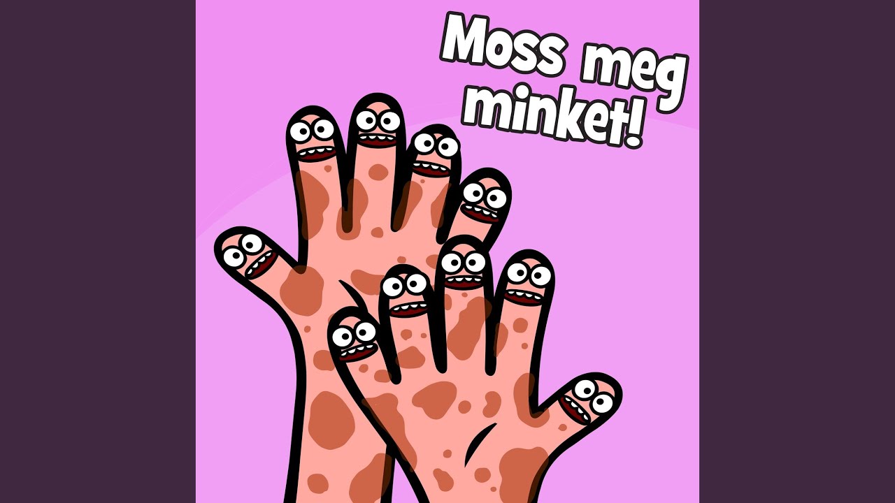 Moss meg minket!