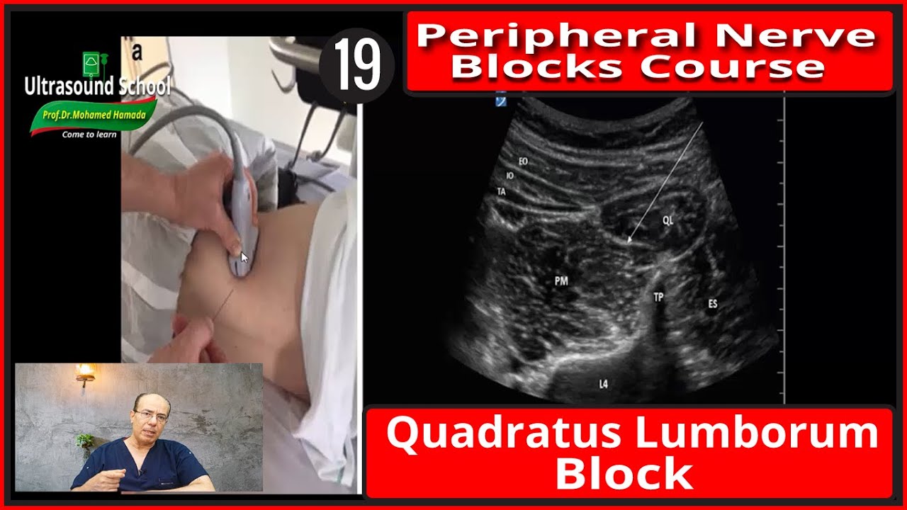 Quadratus Lumborum BLock)Ultrasound Guided peripheral Nerve Blocks Course |Mohamed Hamada|(19)