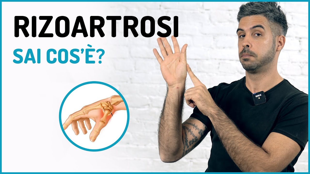 Rizoartrosi - Che cos'è e quali sono le cure  ||| Fisiosalice