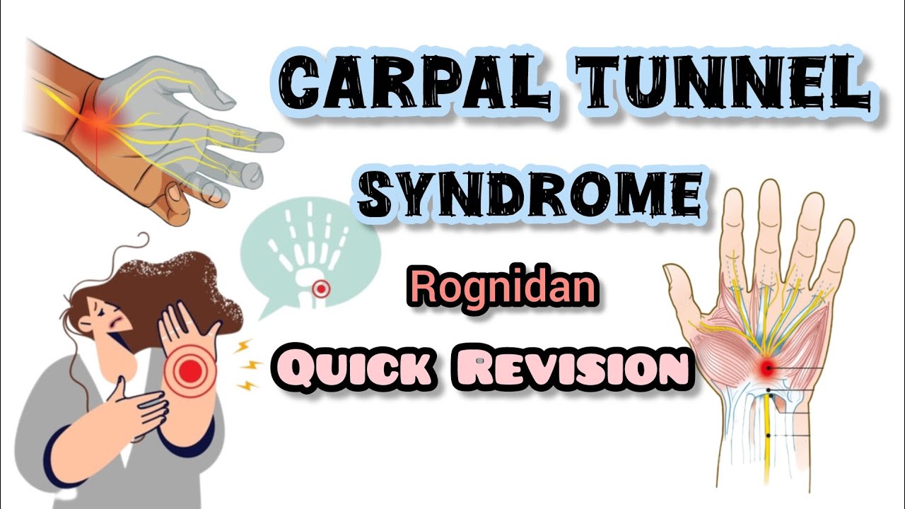Carpal Tunnel Syndrome||Rognidan||Modern Disease||Rapid Revision|| BAMS|| bams mordern disease||