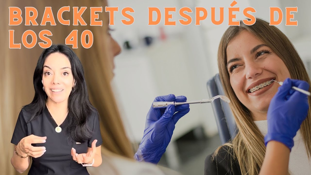 ¿Ortodoncia después de los 40 años? - Brackets y Menopausia