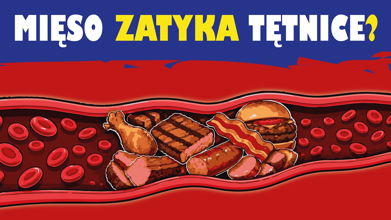 LDL 574, zero blaszki. Niskie LDL, miażdżyca &mdash; co tu się nie zgadza?