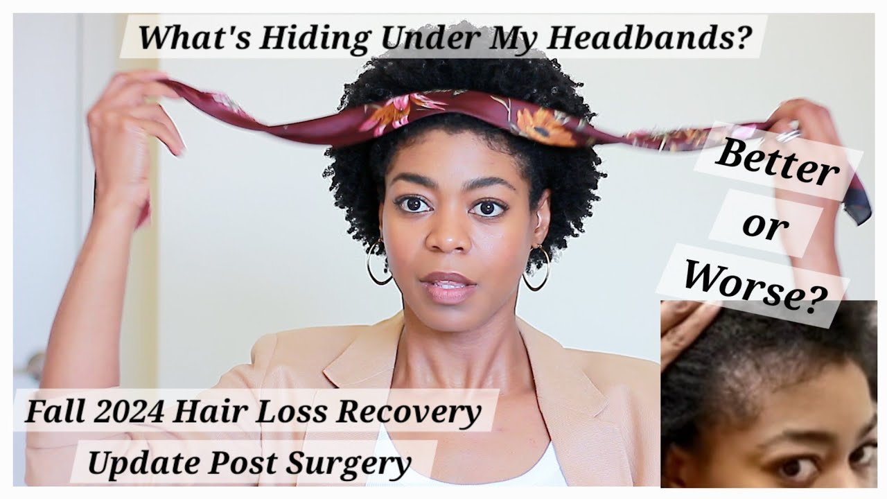 What's Hiding Under My Headbands? - Fall 2024 Hair Loss Update - 4C Natural Hair - NaturalMe4C