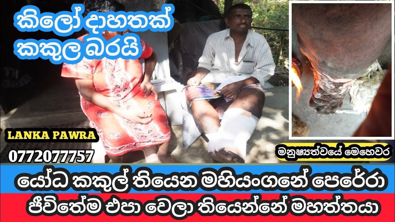 කකුල කිලෝ දාහතක් බරයි හරිම අමාරුයි මහත්මයා/අම්මා බලා ගන්නෙත් මම LANKA PAWRA 