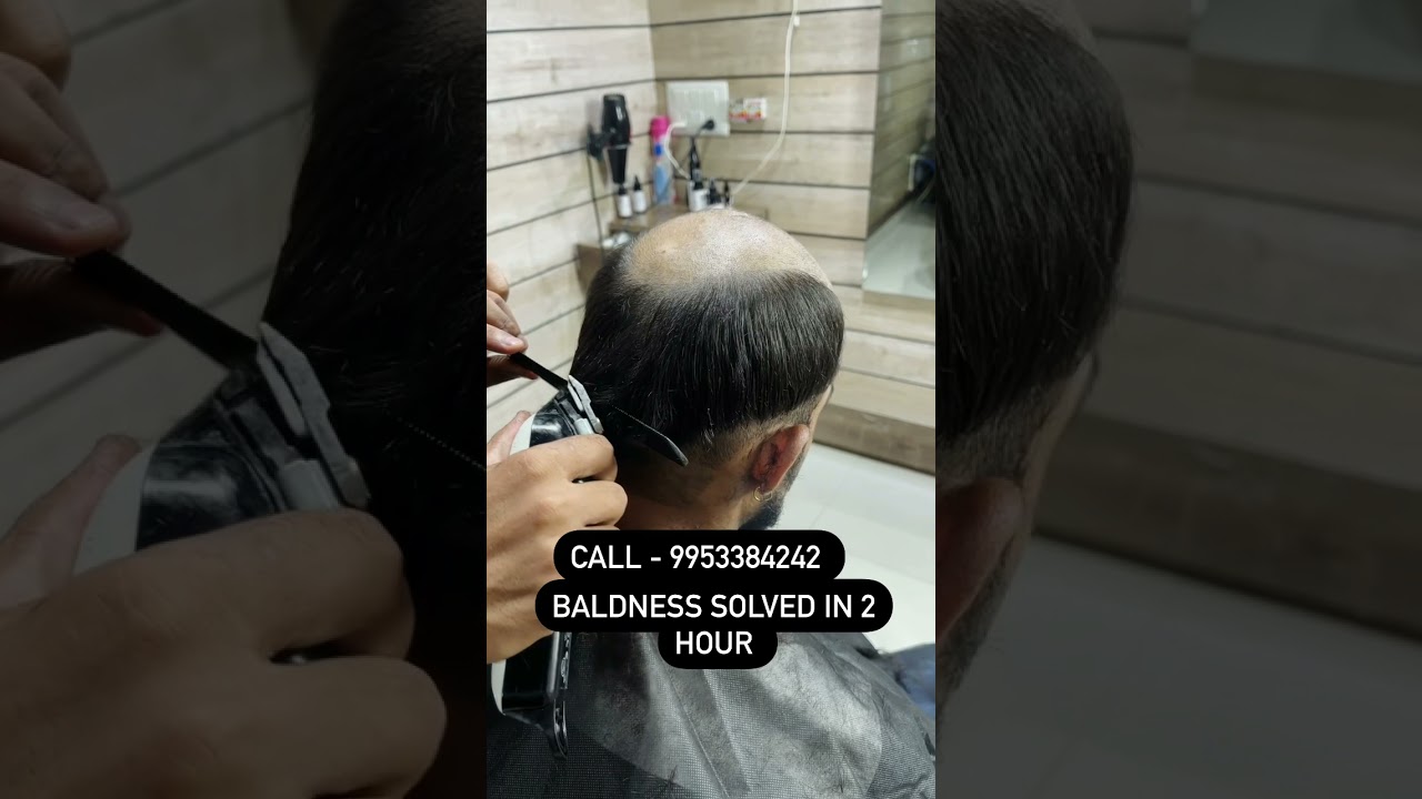 Baldness Solution in 2 Hour | Non surgical Hair Replacement | Hair wig House