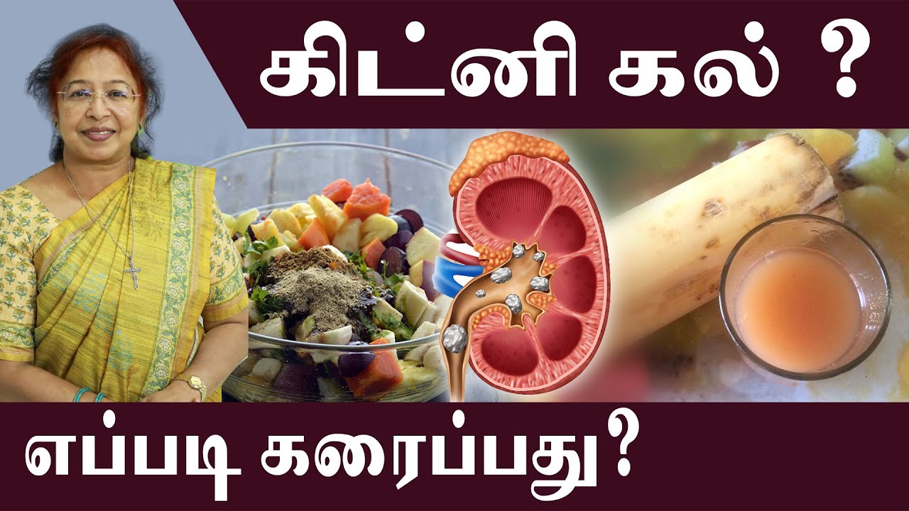 kidney stone ? How to Cure it ? | #daisy #daisyhospital #cure #kidneystone