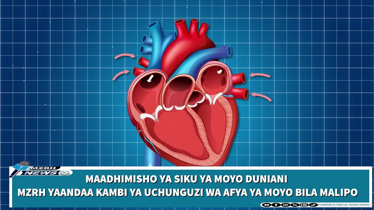 MATIBABU YA MOYO BILA MALIPO