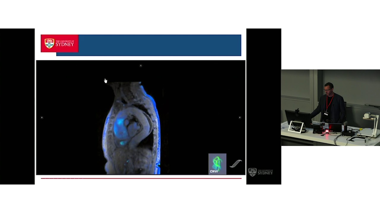 4D-Flow MRI of the Thoracic Aorta - Prof Stuart Grieve