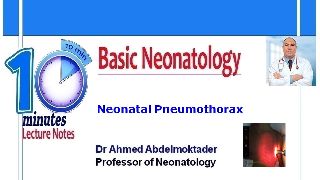 Neonatal Pneumothorax