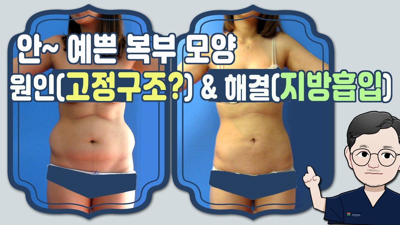 안 예뻤던 복부의 원인과 좋은 해결(지방흡입)