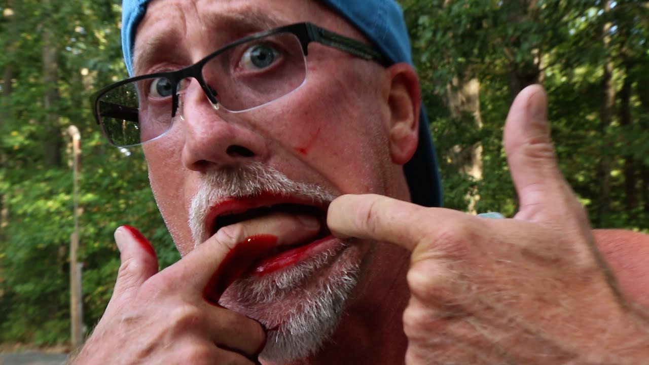 BLOODY TOOTH PRANK!