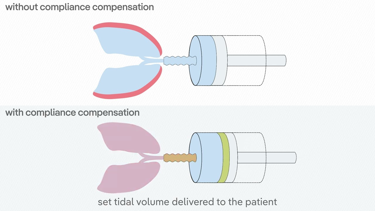 Protective ventilation during pediatric surgery with Atlan anaesthesia workstations