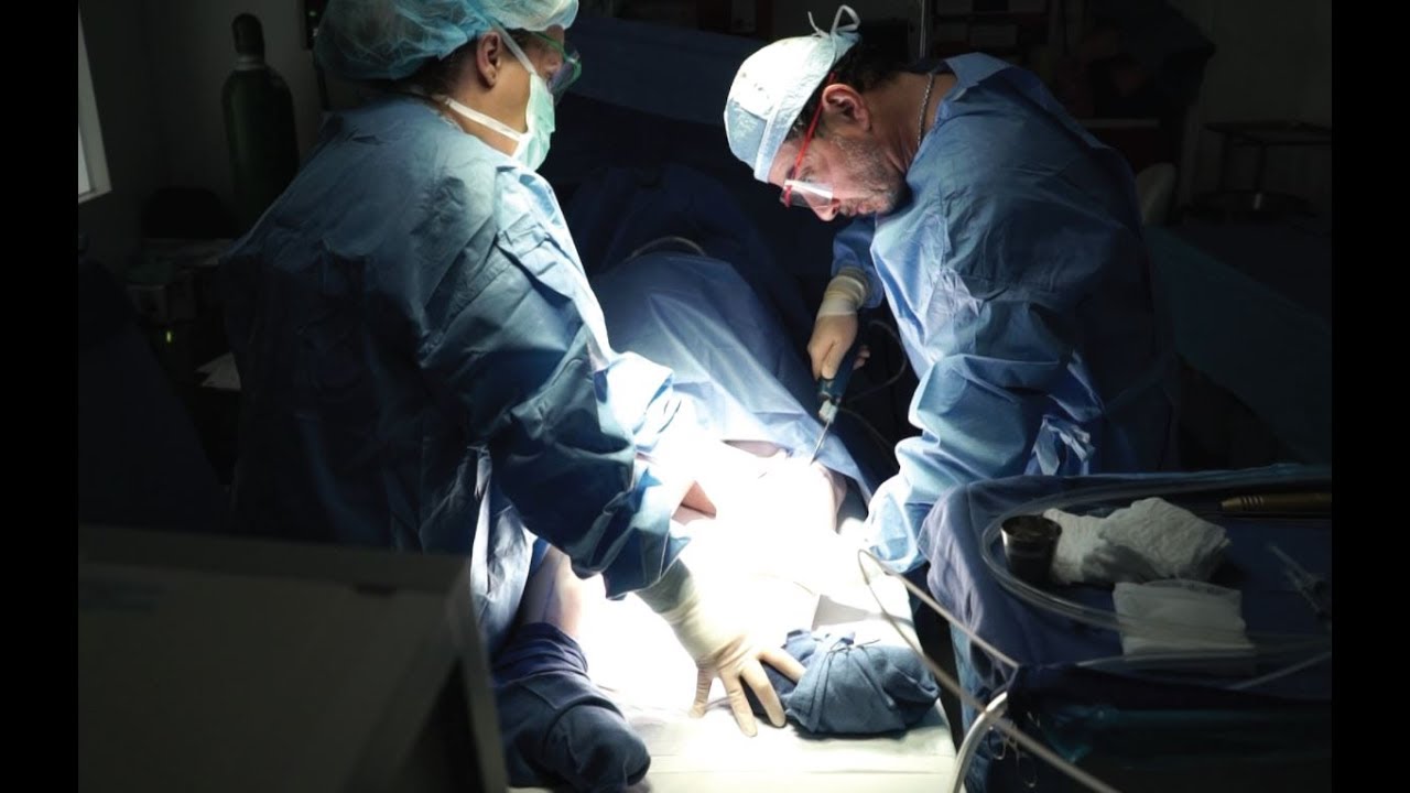 Dr. David Amron's Technique and Anesthesia Choices for Lipedema Surgery
