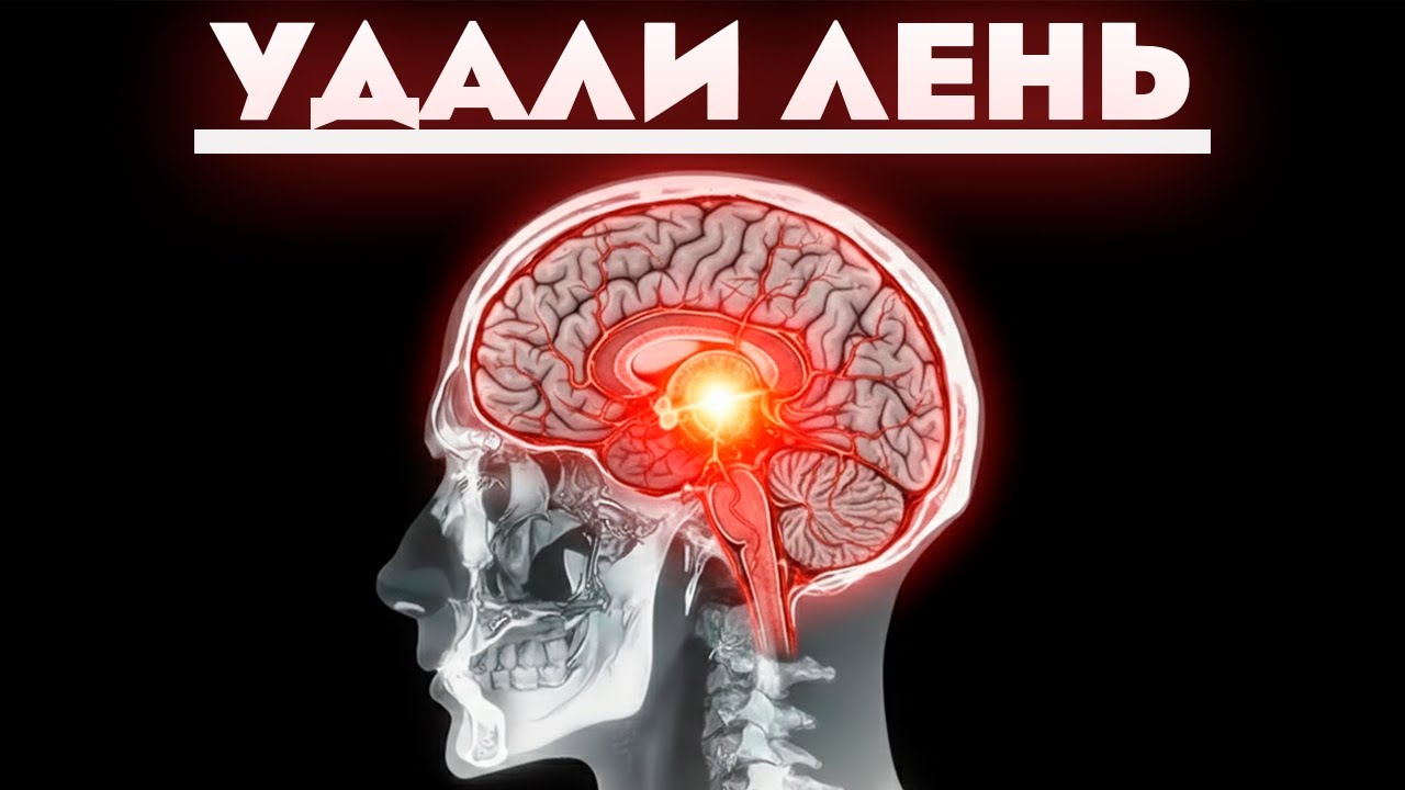 Я НАВСЕГДА избавлю тебя от лени за 6 минут (гайд без дер%ма)
