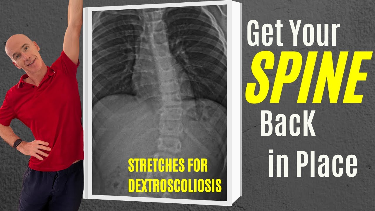 3 Corrective Exercises to Straighten Dextroscoliosis #scoliosistreatment #scoliosistherapy