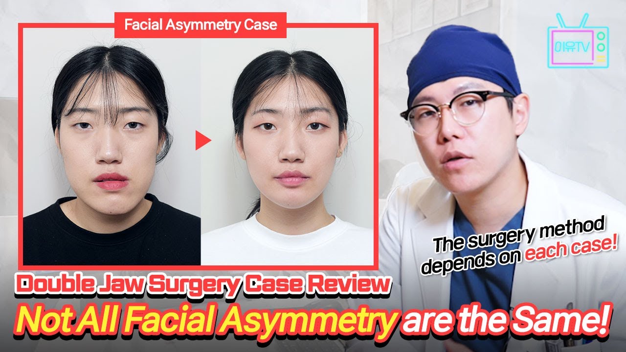 [EN/JP/TH/ SUB] Korean Double Jaw Surgery Case Review: Facial Asymmetry