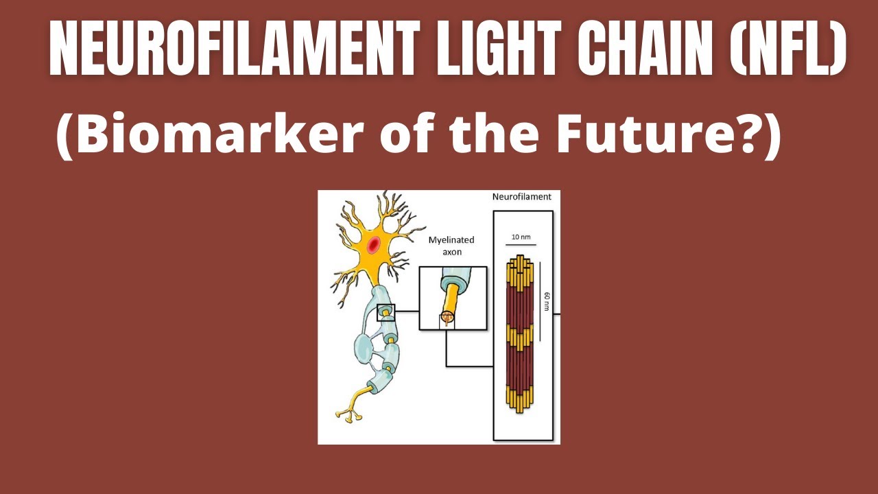 Neurofilament Light Chain (NfL) as a Biomarker in Neurological Disorders