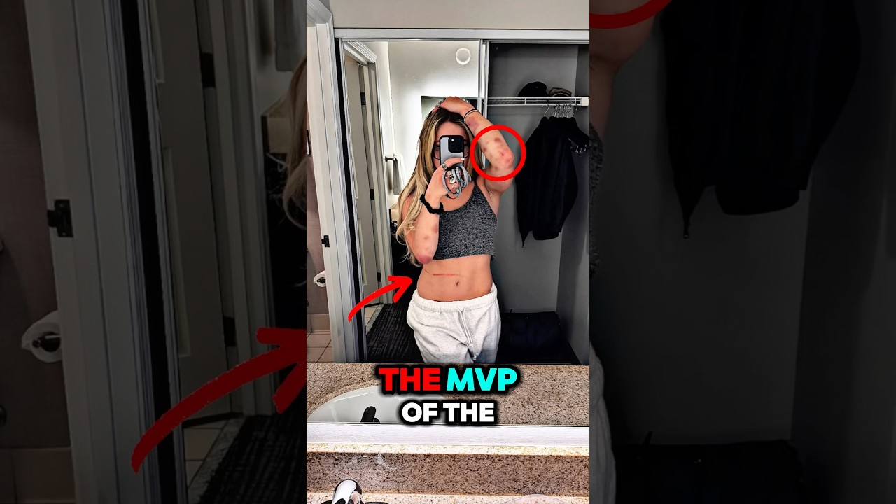 Liv Morgan EXTREMELY HURT After Elimination Chamber Performance 🙌 