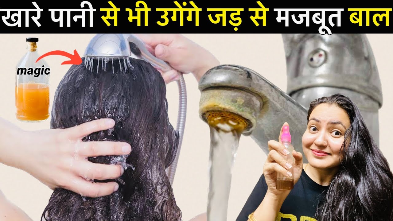 Hard Water Hair Growth Challenge : Try This *Secret Formula* & Your Hair will Never Stop Growing❤️