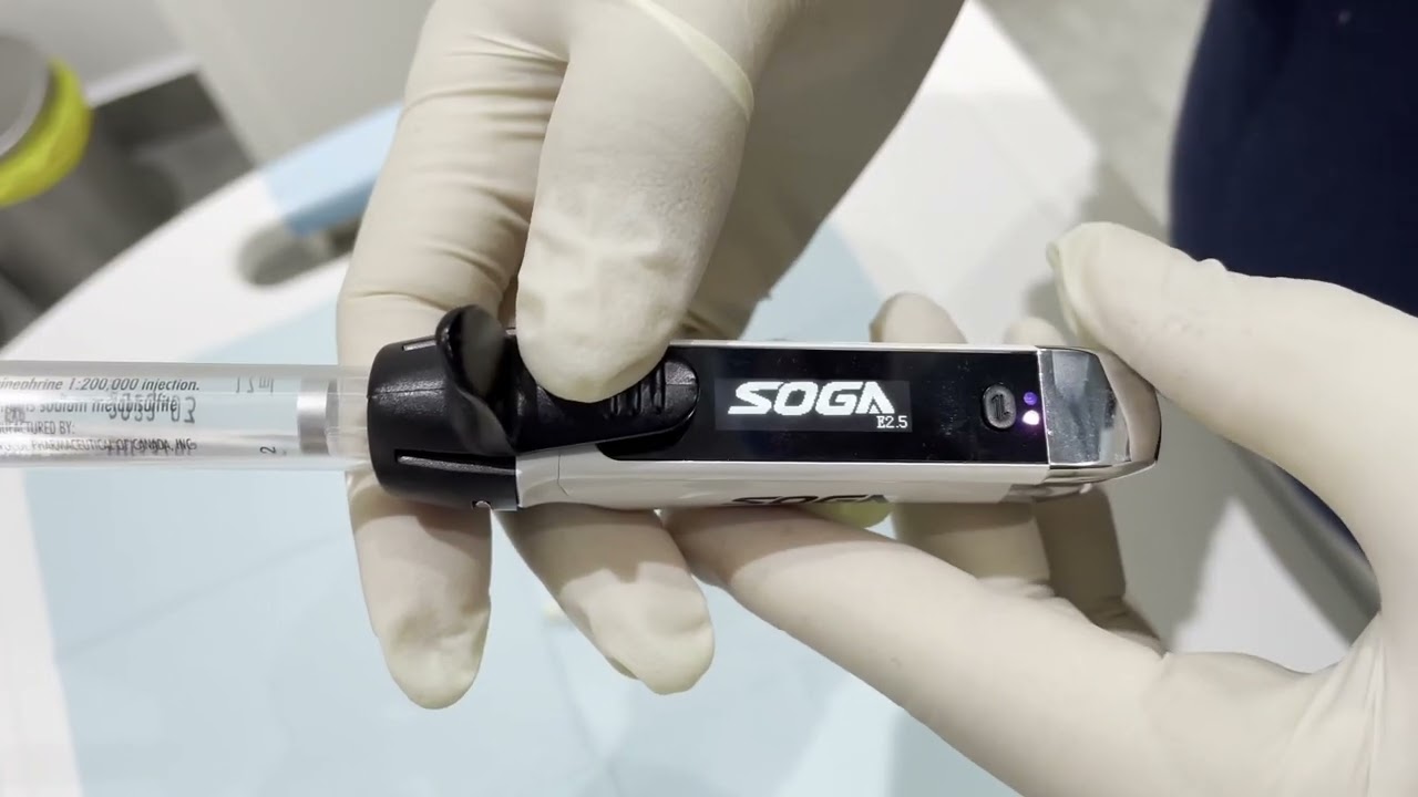 طريقه ابره ال intraligamentary باستخدام جهاز Soga