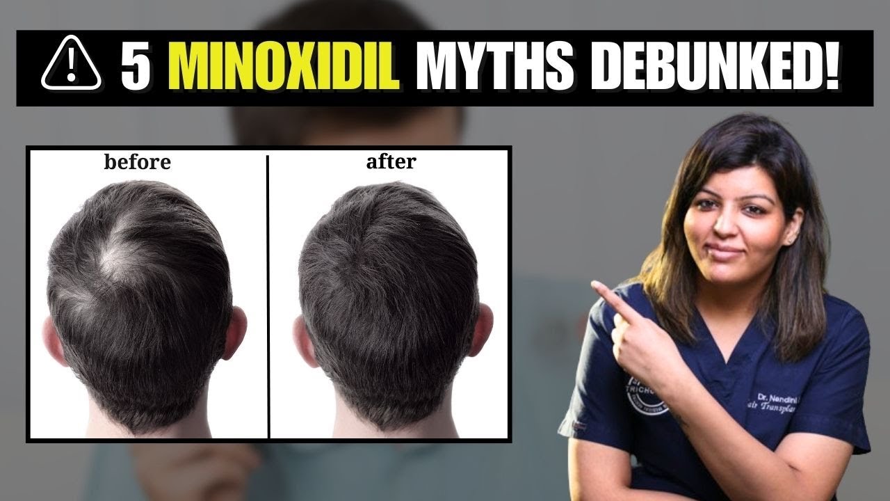Minoxidil Myths Busted! 5 Lies You Still Believe About Hair Growth | Dr Nandini Dadu