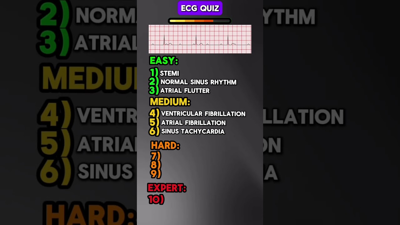 Can you get 10/10? ECG/EKG Quiz📈 #quiz #paramedic #doctor #nursing #medicalstudent #ecg #ekg
