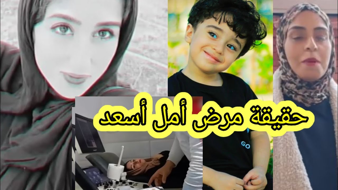 حقيقة مرض أمل اسعد وسبب خوفها وبكاءها ونتيجة الأشعة اللى عملتها 