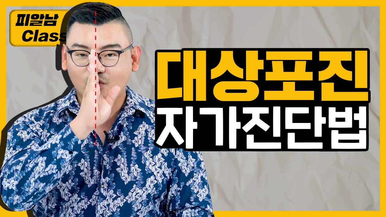 통증이 '이런 패턴'이면 대상포진입니다 (자가진단법) by 피부과전문의