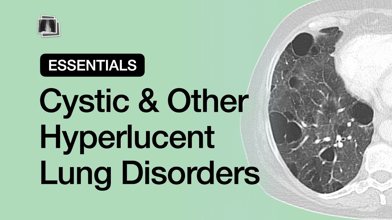 Cystic & Other Hyperlucent Lung Disorders | Chest Radiology Essentials
