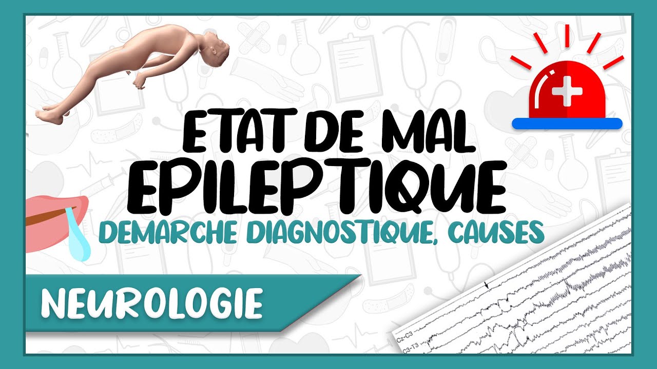Comprendre L'état de mal épileptique : Définition, Diagnostic, Classification, Les étiologies