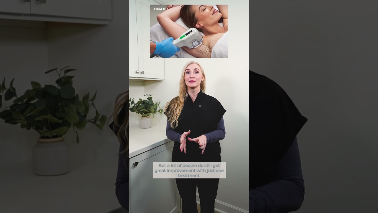 MiraDry vs. Botox: Which is better for treating excessive sweating? 💧