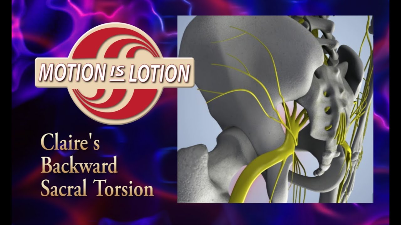 Treating SI joints and Backward Sacral Torsion