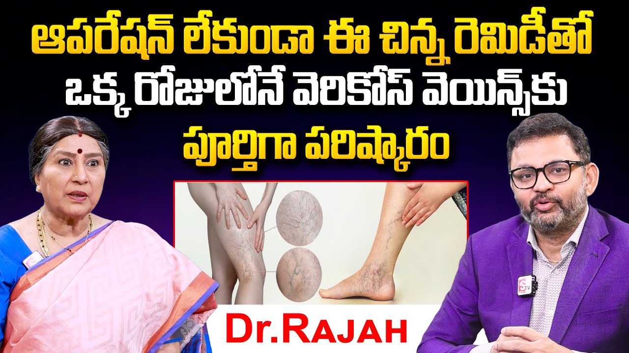 ఆపరేషన్ లేకుండా వెరికోస్ వెయిన్స్ కు పూర్తిగా పరిష్కారం | Dr Rajah With Annapurna | Avis Hospitals