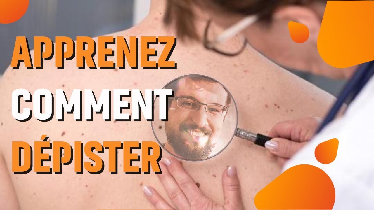 DÉPISTER LE CANCER DE LA PEAU (facilement)