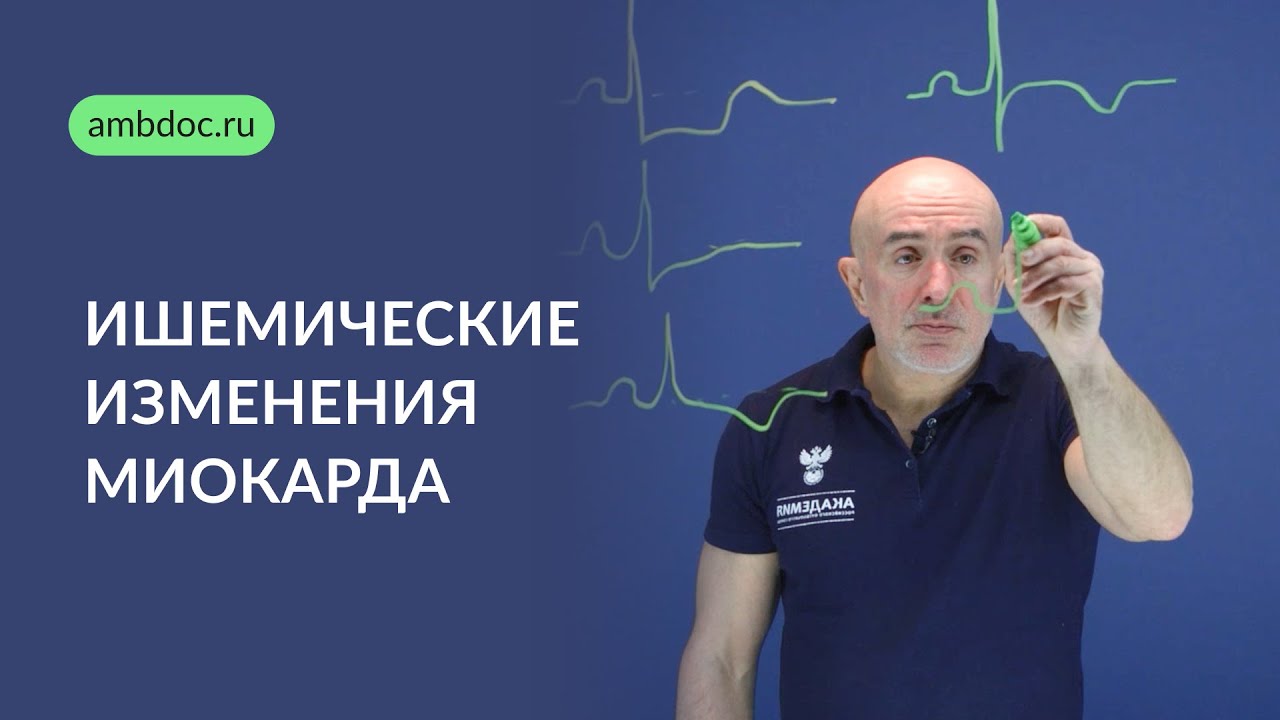 Ишемические изменения миокарда на ЭКГ