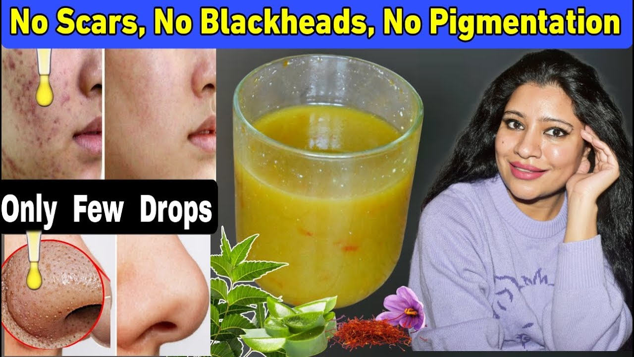 Use Just 4 Drops In Night & Use FaceWash Paste To Remove Pigmentation,Scars,Acne,Blackheads.