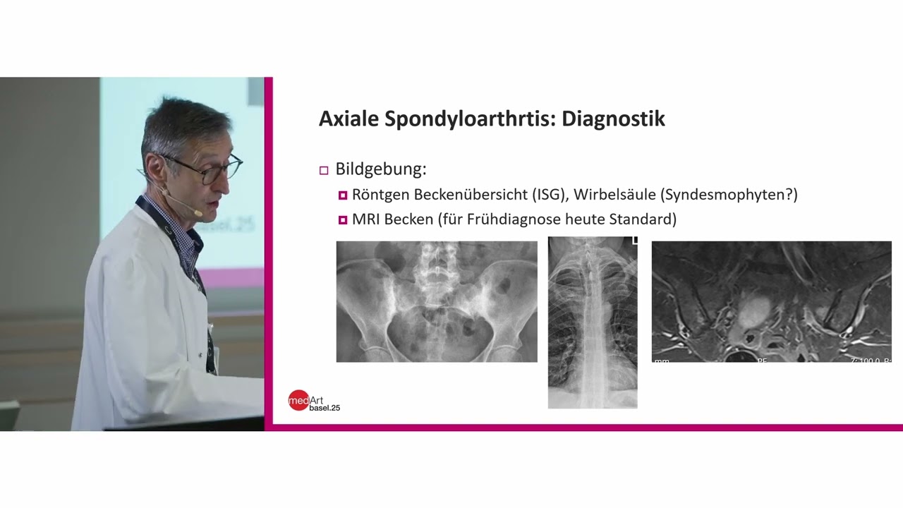 medArt 2025 | Dienstag | 01 Spondyloarthritis |  D. Kyburz