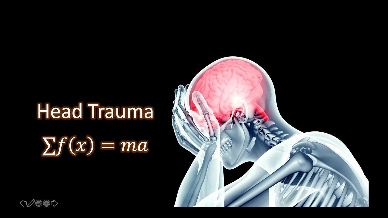 Head Trauma & Force Vectors