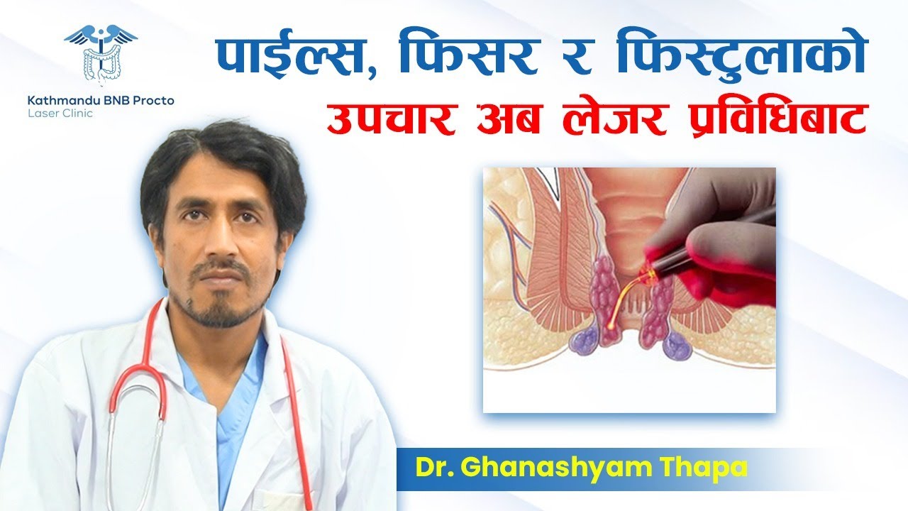 पाइल्स, फिसर र फिस्टुला के हो ? यसको लेजर प्रविधिबाट कसरी उपचार गरिन्छ?