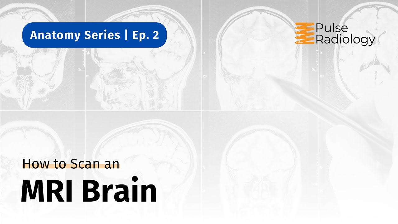 How to Scan an MRI Brain