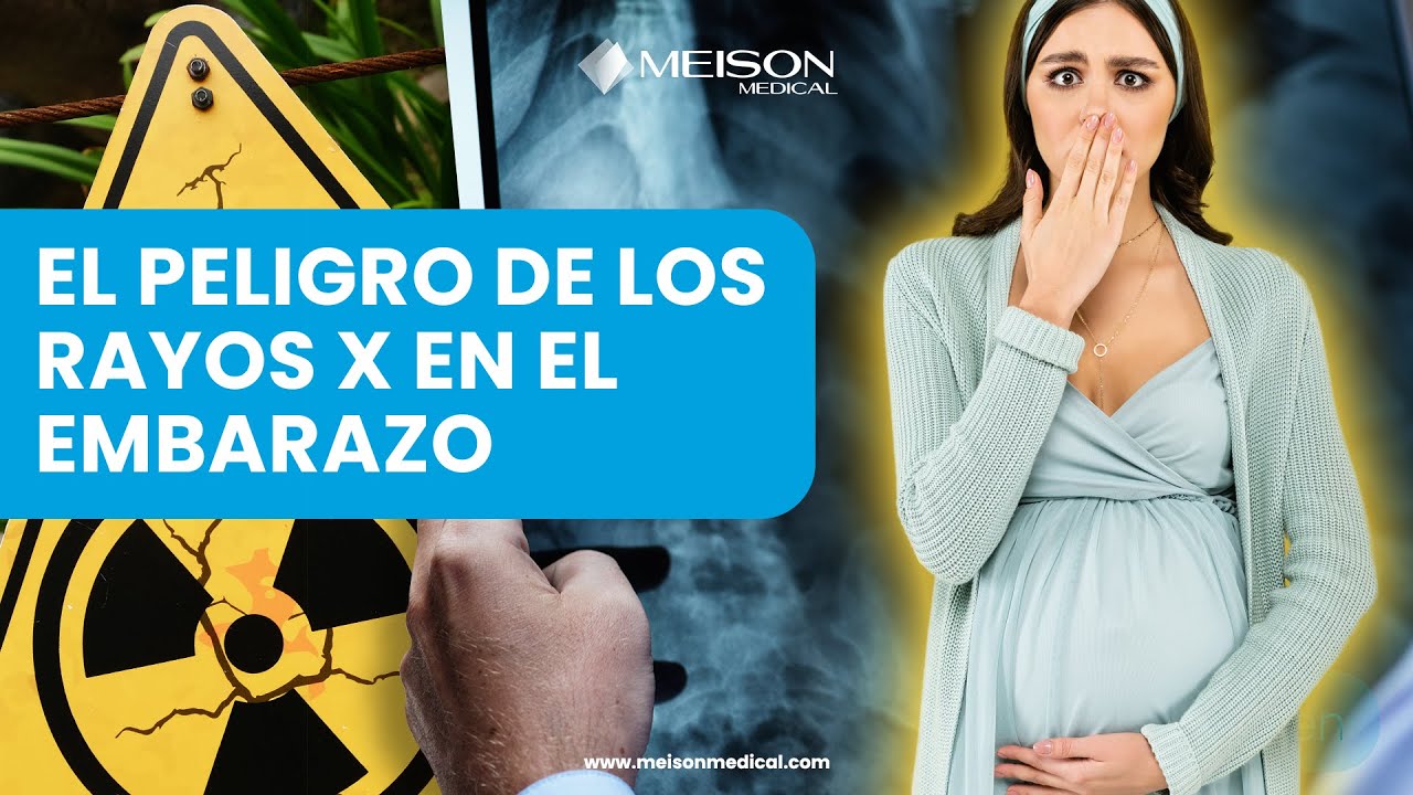 El Peligro de los Rayos X en el Embarazo 👩🏻‍⚕️🤰🏻🦴😱