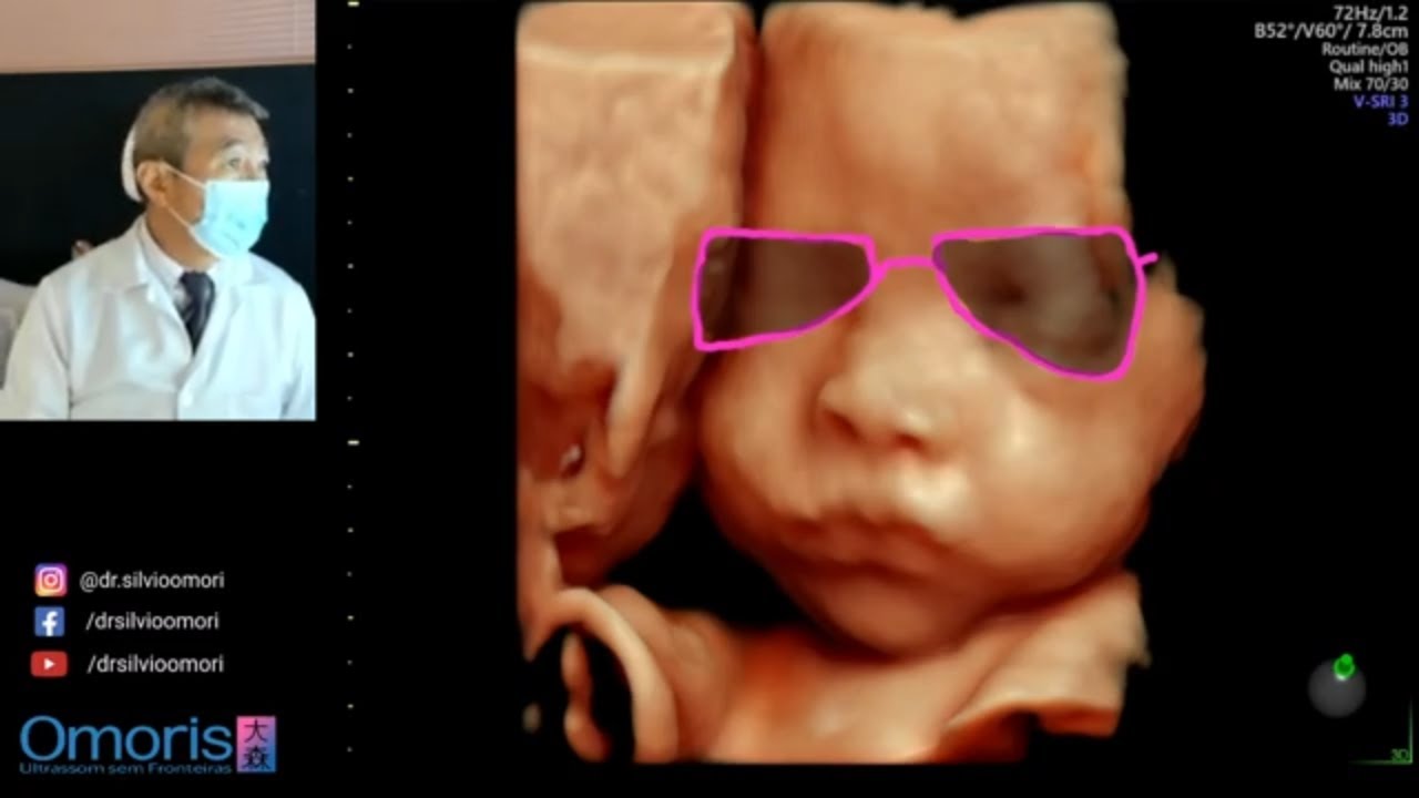 3D/4D GRAVIDEZ 28 semanas.