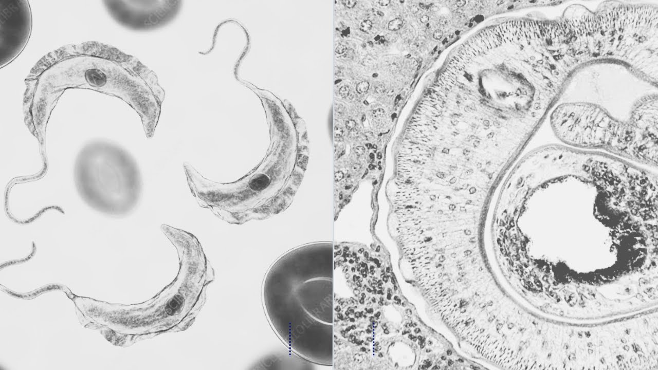 Enfermedad de Chagas y Esquistosomiasis
