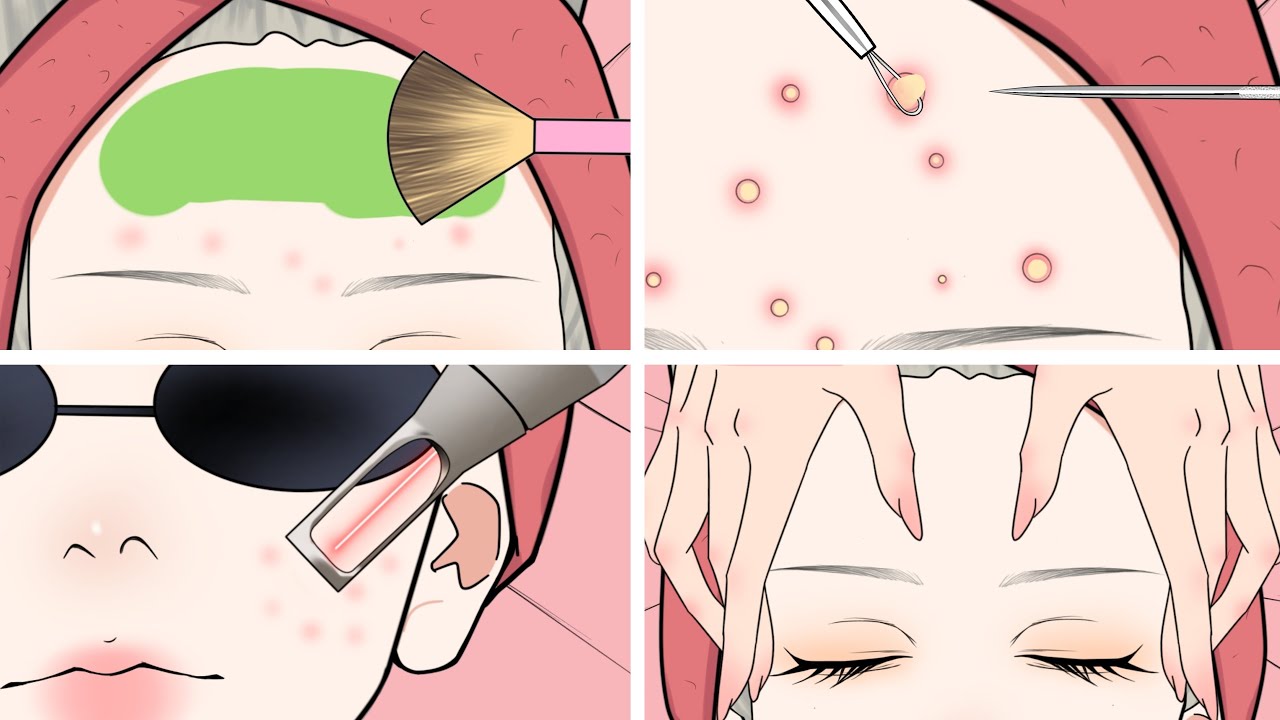 ASMR Facial treatment to clear pimples ( ASMR Animation)